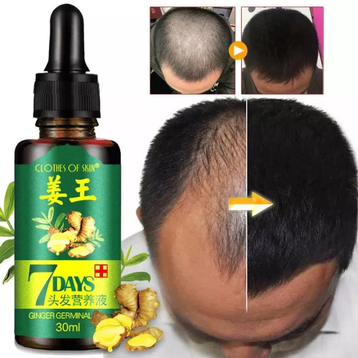 7 Day Ginger Oil – Natural Herbal Hair Growth Serum (30ML buy  1 get 1 fee