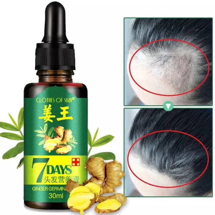 7 Day Ginger Oil – Natural Herbal Hair Growth Serum (30ML buy  1 get 1 fee