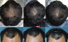 ReRoot Organic Hair Growth Oil (100ml)