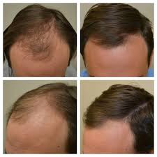 ReRoot Organic Hair Growth Oil (100ml)